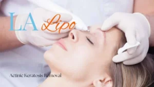 Woman receiving Actinic Keratosis Removal Treatment Waltham Abbey
