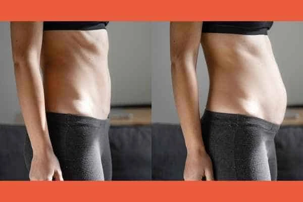LA-EMS Body Sculpting results Waltham Abbey