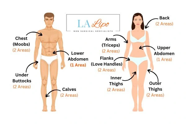 LA LIPO Cryolipolysis Areas Waltham Abbey