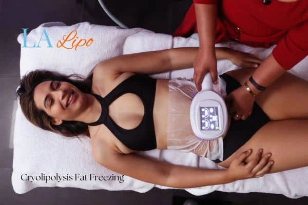 woman getting cryolipolysis Waltham Abbey