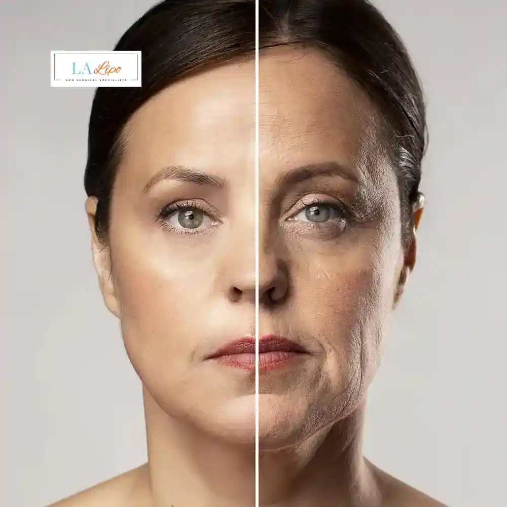 How Can You Tell If Non-Surgical Skin Tightening Is Right for You Waltham Abbey?