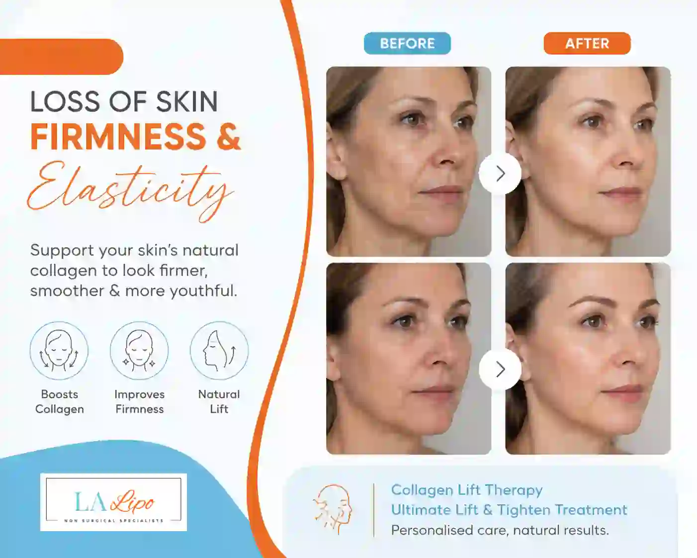 Sign #7: Loss of Skin Firmness and Elasticity Waltham Abbey