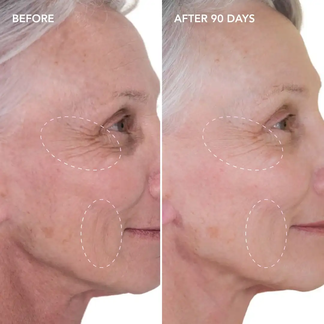 When will you see results Waltham Abbey